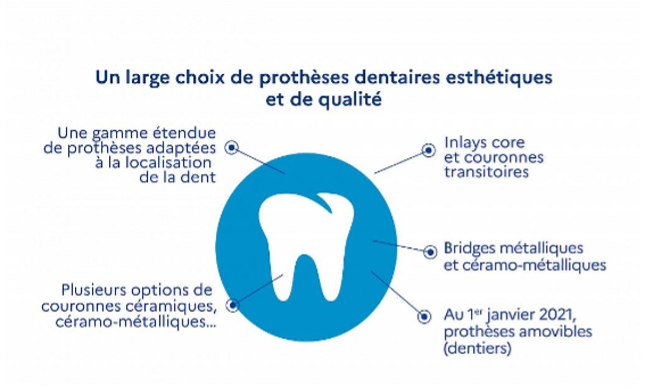 Réforme 100% santé : impact sur l’activité dentaire - Un large choix de prothèse dentaires esthétiques et de qualité