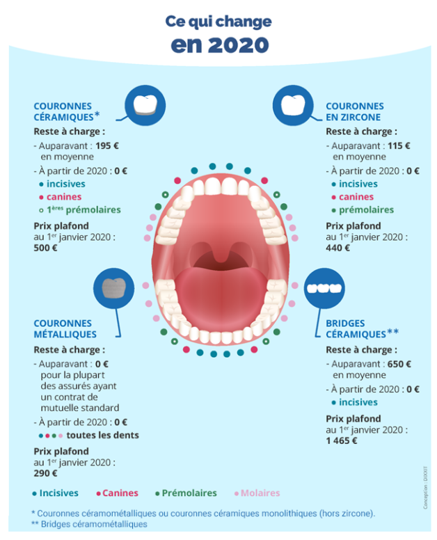 Réforme 100% santé : impact sur l’activité dentaire - ce qui change en 2020
